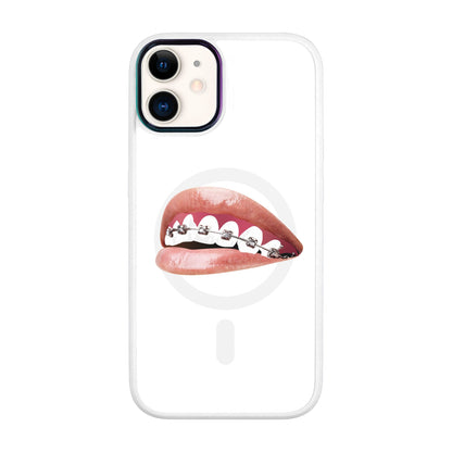 ORTHODONTİST-Vigor Kılıf MagSafe Özellikli - iPhone 11