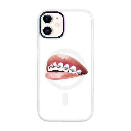 ORTHODONTİST-Vigor Kılıf MagSafe Özellikli - iPhone 11