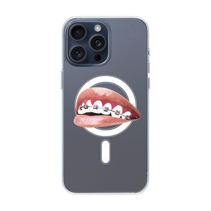 ORTHODONTIST-iPhone 15 Pro Max Solid Kılıf MagSafe Özellikli