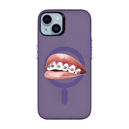 ORTHODONTIST-iPhone 14 Plus Hold Kılıf MagSafe Özellikli
