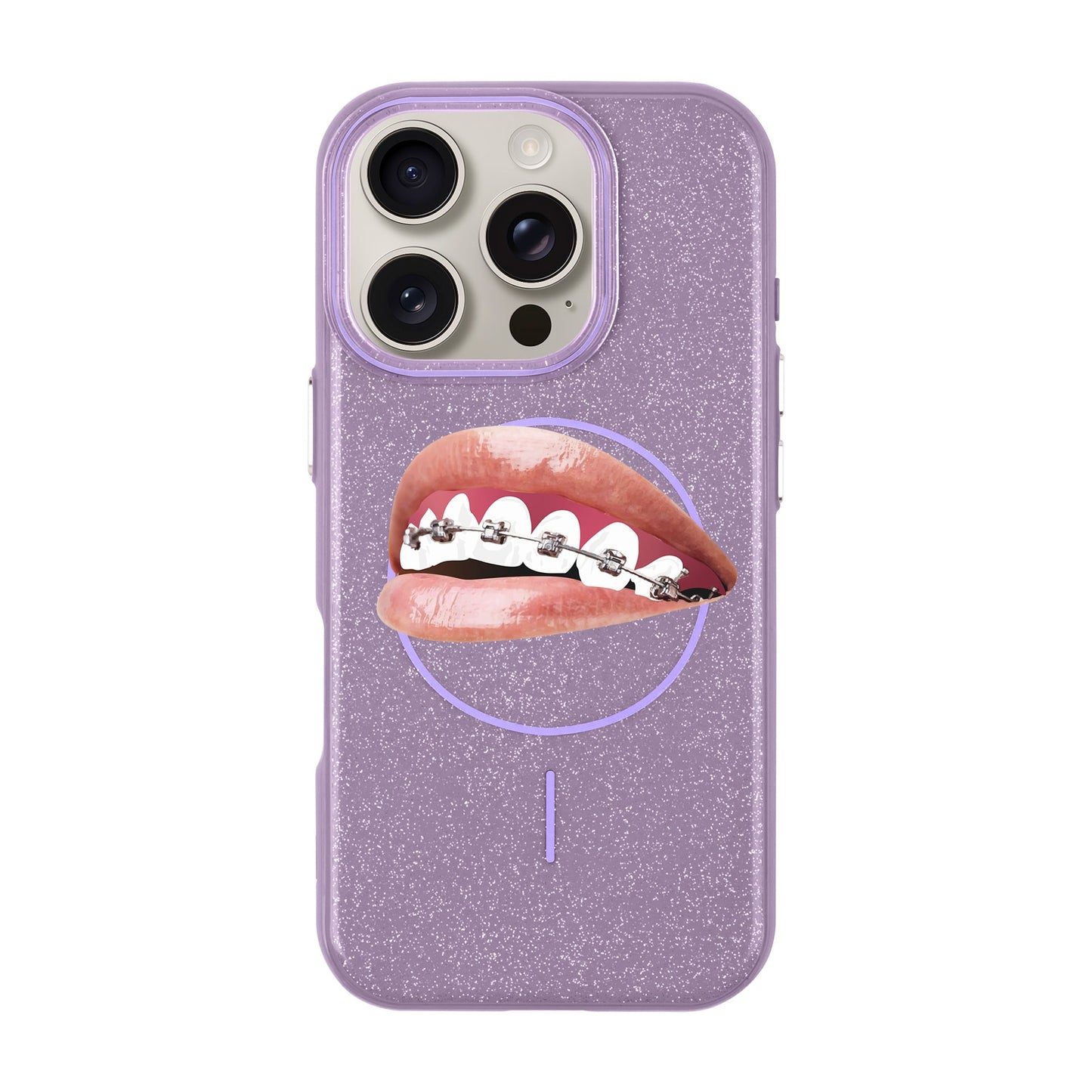 ORTHODONTIST-iPhone 16 Pro Radiant Kılıf MagSafe Özellikli