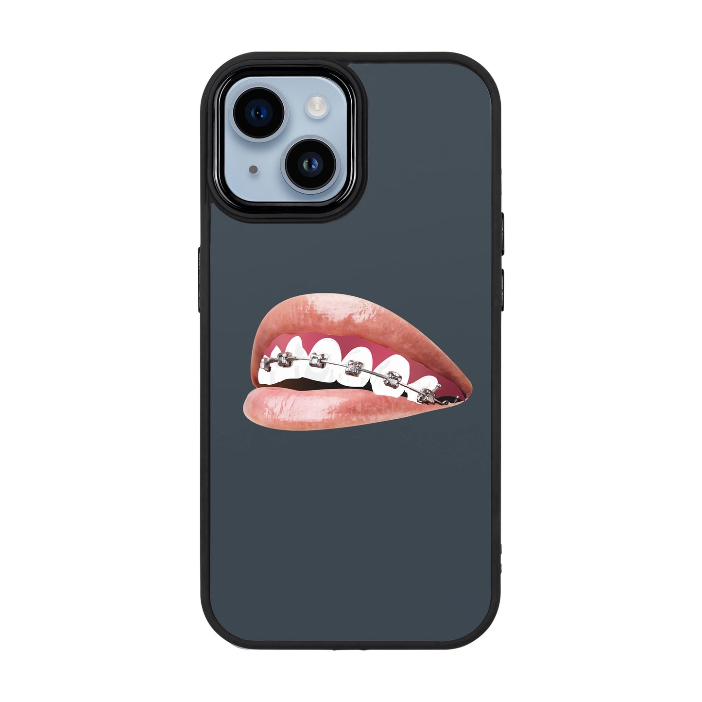 ORTHODONTIST-Proof Kılıf - iPhone 14