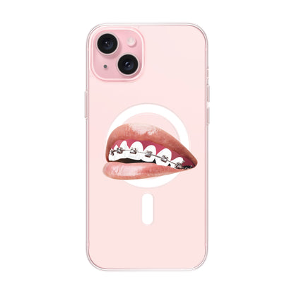 ORTHODONTIST-iPhone 15 Plus Solid Kılıf MagSafe Özellikli