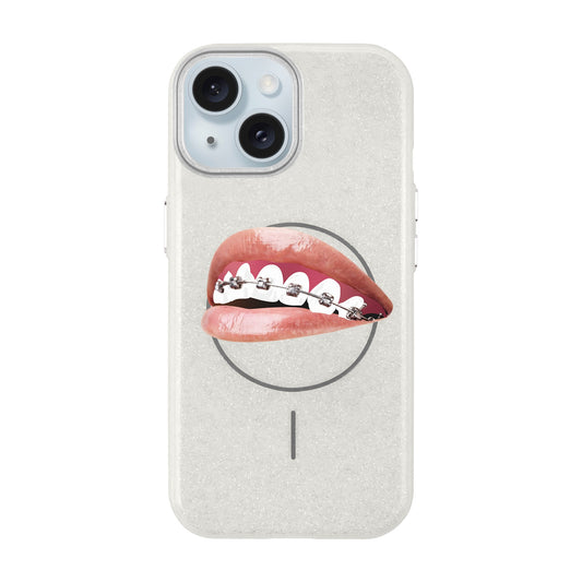 ORTHODONTIST-iPhone 15 Plus Radiant Kılıf MagSafe Özellikli