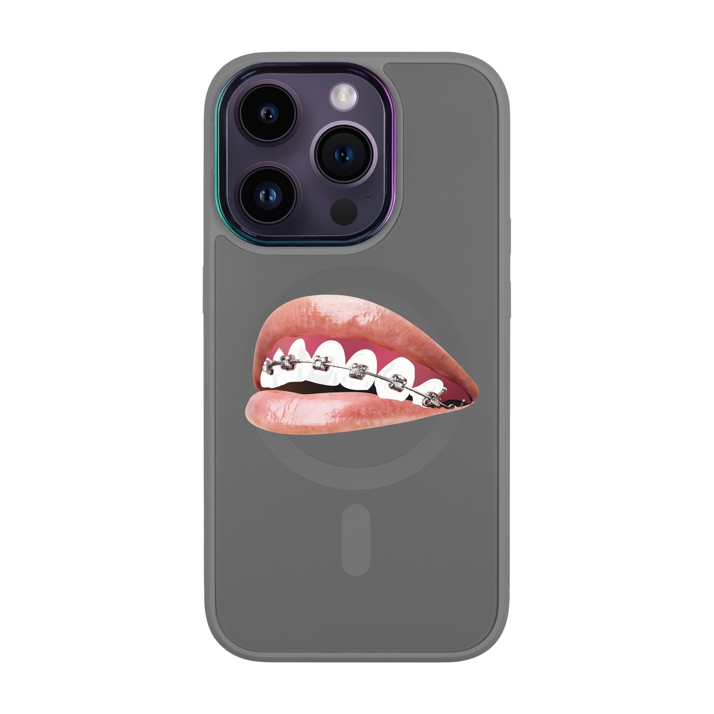 ORTHODONTİST-Vigor Kılıf MagSafe Özellikli - iPhone 14 Pro