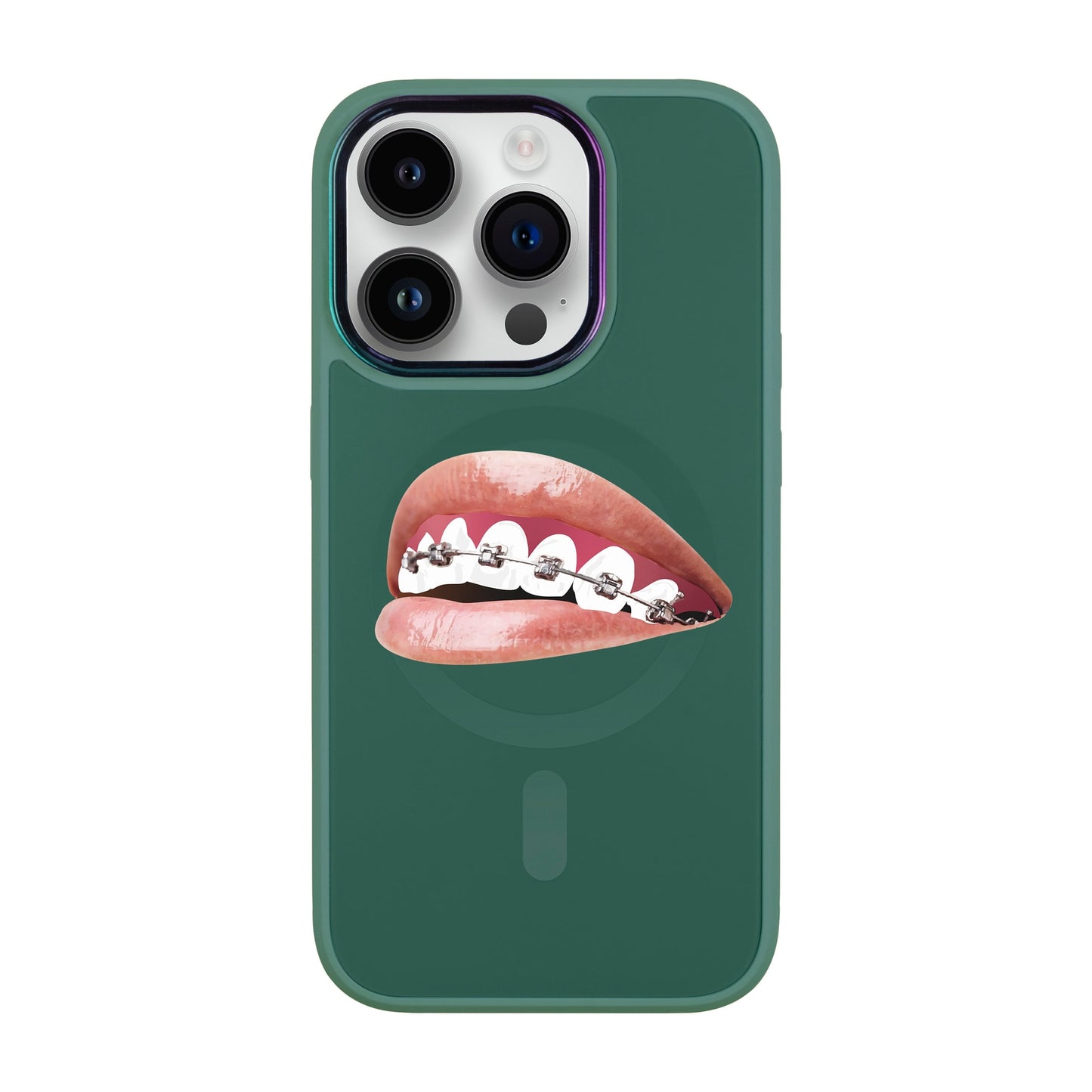 ORTHODONTİST-Vigor Kılıf MagSafe Özellikli - iPhone 14 Pro