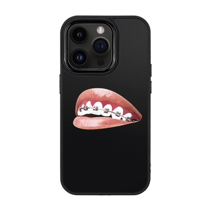 ORTHODONTIST-iPhone 14 Pro Proof Kılıf