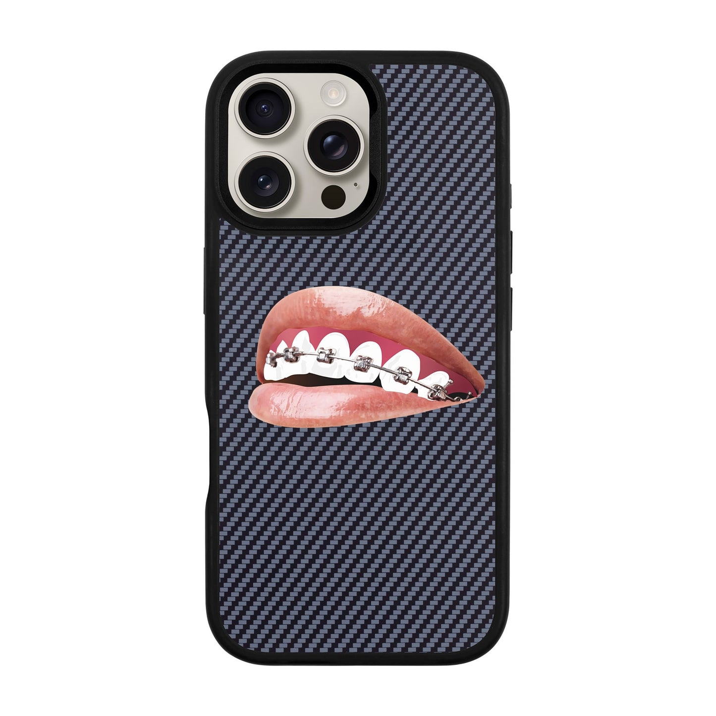ORTHODONTIST-iPhone 16 Pro Max Plaid Kılıf MagSafe Özellikli
