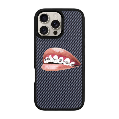 ORTHODONTIST-iPhone 16 Pro Max Plaid Kılıf MagSafe Özellikli