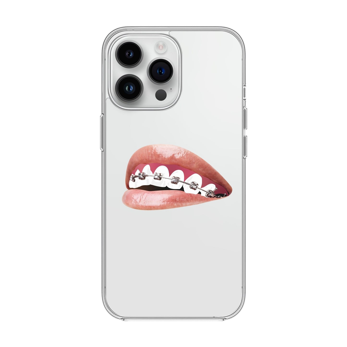 ORTHODONTIST-iPhone 14 Pro Max Solid Kılıf