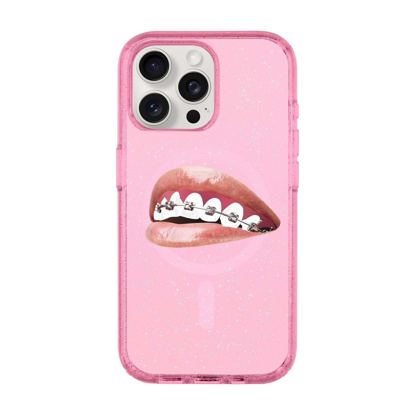 ORTHODONTIST-iPhone 15 Pro Max Shiny Kılıf MagSafe Özellikli