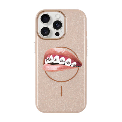 ORTHODONTIST-iPhone 15 Pro Max Radiant Kılıf MagSafe Özellikli