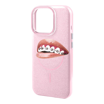 ORTHODONTIST-iPhone 16 Pro Max Radiant Kılıf MagSafe Özellikli