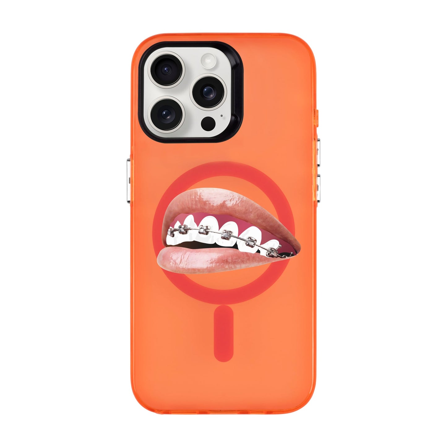 ORTHODONTIST-iPhone 15 Pro Max Hold Kılıf MagSafe Özellikli