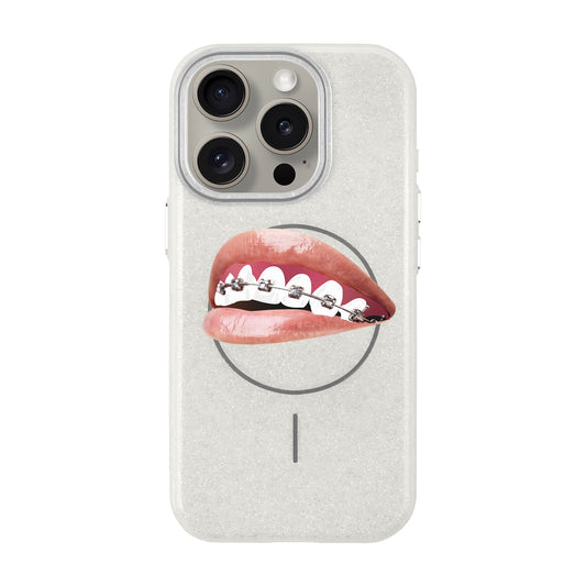 ORTHODONTIST-iPhone 15 Pro Radiant Kılıf MagSafe Özellikli