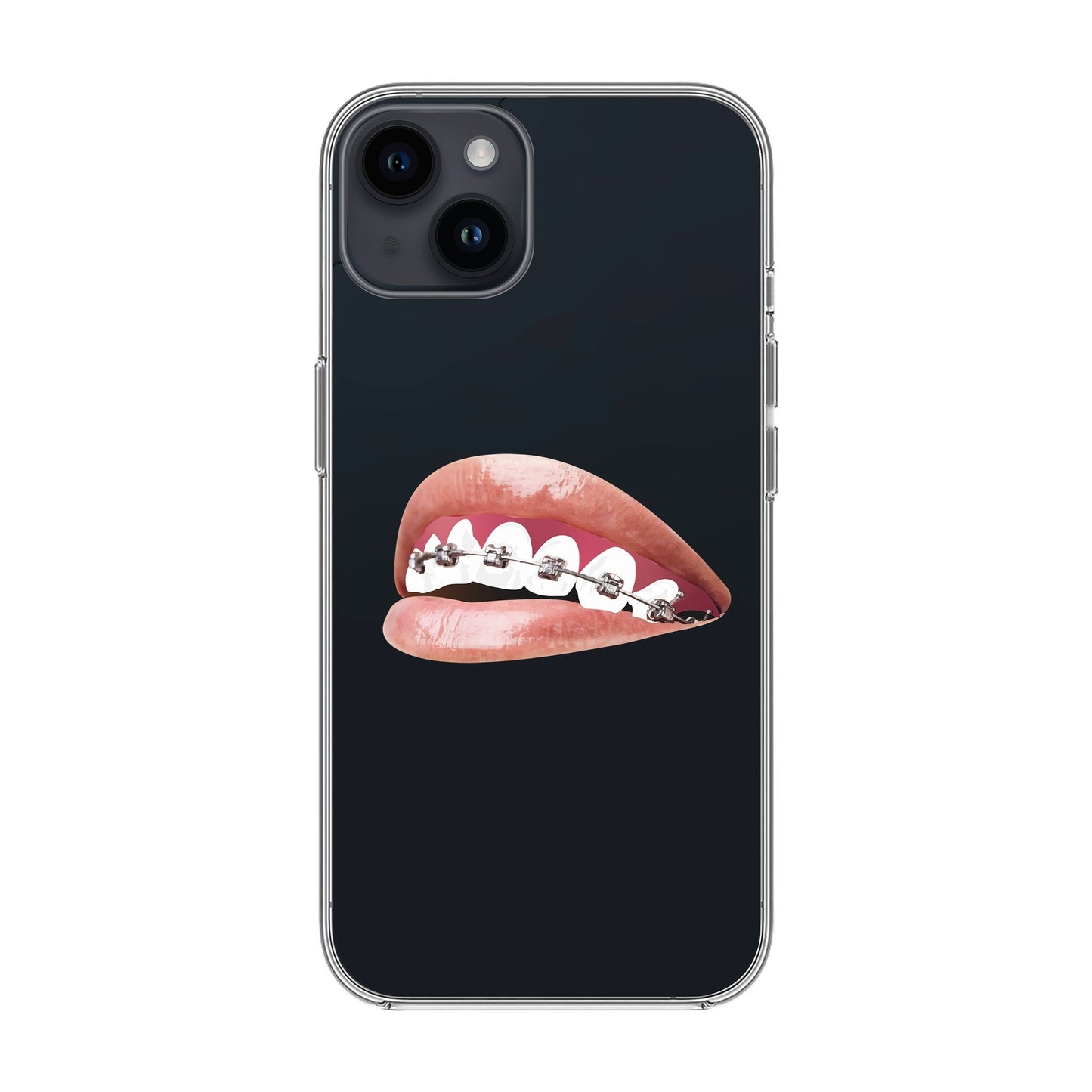 ORTHODONTIST-iPhone 14 Plus Solid Kılıf