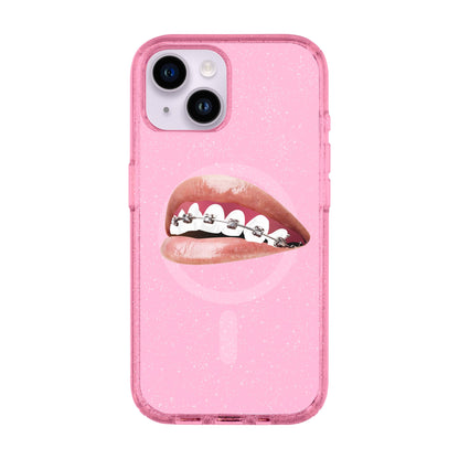 ORTHODONTIST-Shiny Kılıf MagSafe Özellikli - iPhone 13