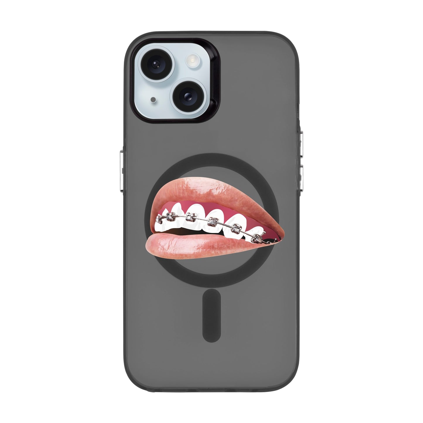 ORTHODONTIST-iPhone 15 Hold Kılıf MagSafe Özellikli