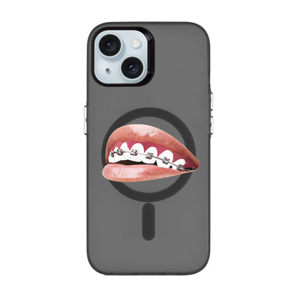 ORTHODONTIST-iPhone 15 Hold Kılıf MagSafe Özellikli