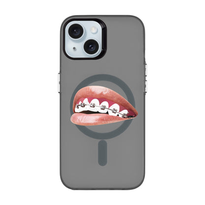 ORTHODONTIST-iPhone 15 Hold Kılıf MagSafe Özellikli