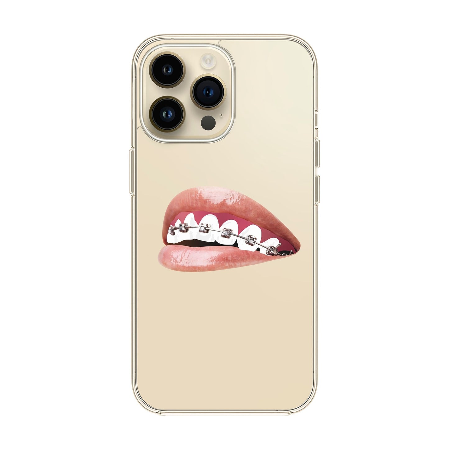 ORTHODONTIST-iPhone 14 Pro Max Solid Kılıf