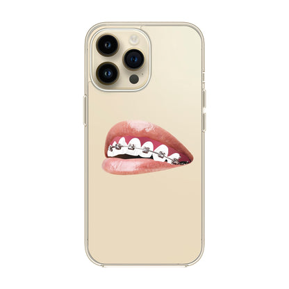 ORTHODONTIST-iPhone 14 Pro Max Solid Kılıf