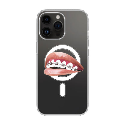 ORTHODONTIST-iPhone 14 Pro Max Solid Kılıf MagSafe Özellikli