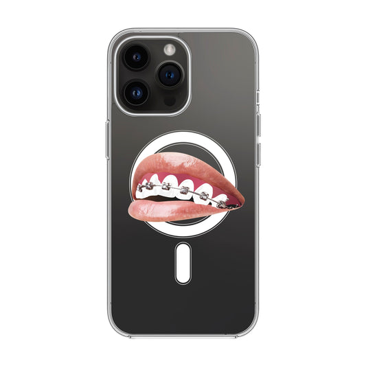 ORTHODONTIST-iPhone 14 Pro Max Solid Kılıf MagSafe Özellikli