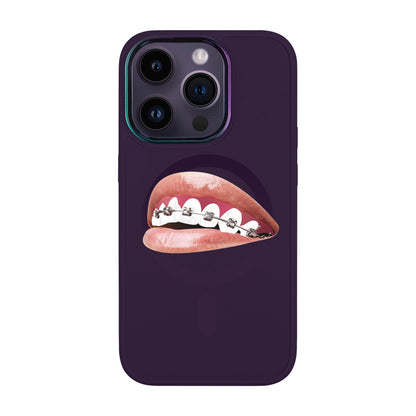 ORTHODONTİST-Vigor Kılıf MagSafe Özellikli - iPhone 14 Pro