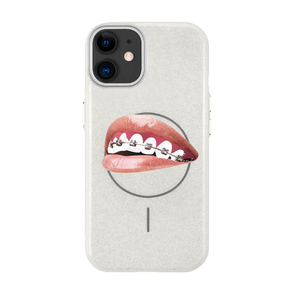 ORTHODONTIST-Radiant Kılıf MagSafe Özellikli - iPhone 11