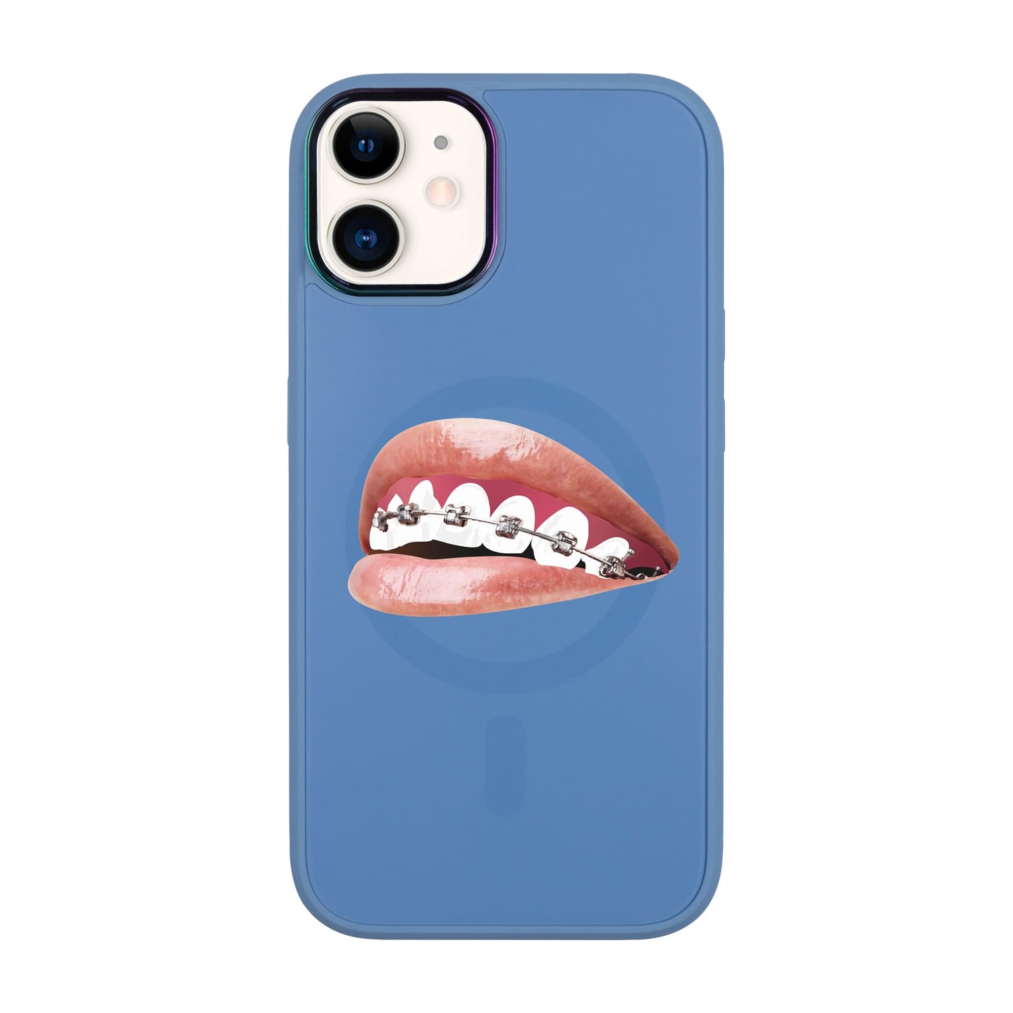 ORTHODONTİST-Vigor Kılıf MagSafe Özellikli - iPhone 11