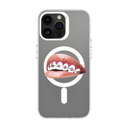 ORTHODONTIST-iPhone 14 Pro Max Hold Kılıf MagSafe Özellikli