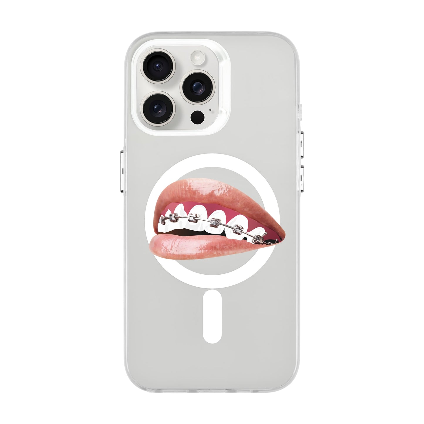ORTHODONTIST-iPhone 15 Pro Max Hold Kılıf MagSafe Özellikli