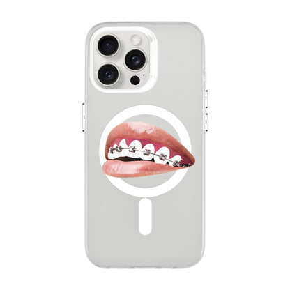 ORTHODONTIST-iPhone 15 Pro Max Hold Kılıf MagSafe Özellikli