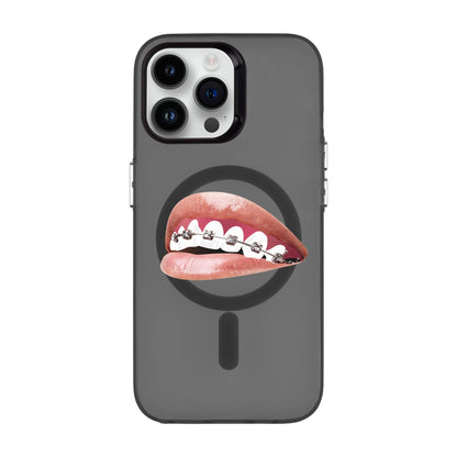 ORTHODONTIST-iPhone 14 Pro Max Hold Kılıf MagSafe Özellikli