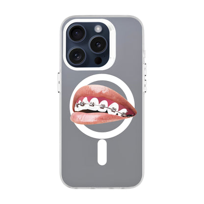 ORTHODONTIST-iPhone 15 Pro Hold Kılıf MagSafe Özellikli