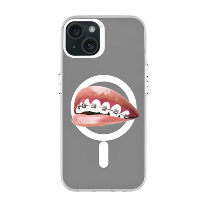 ORTHODONTIST-iPhone 15 Plus Hold Kılıf MagSafe Özellikli