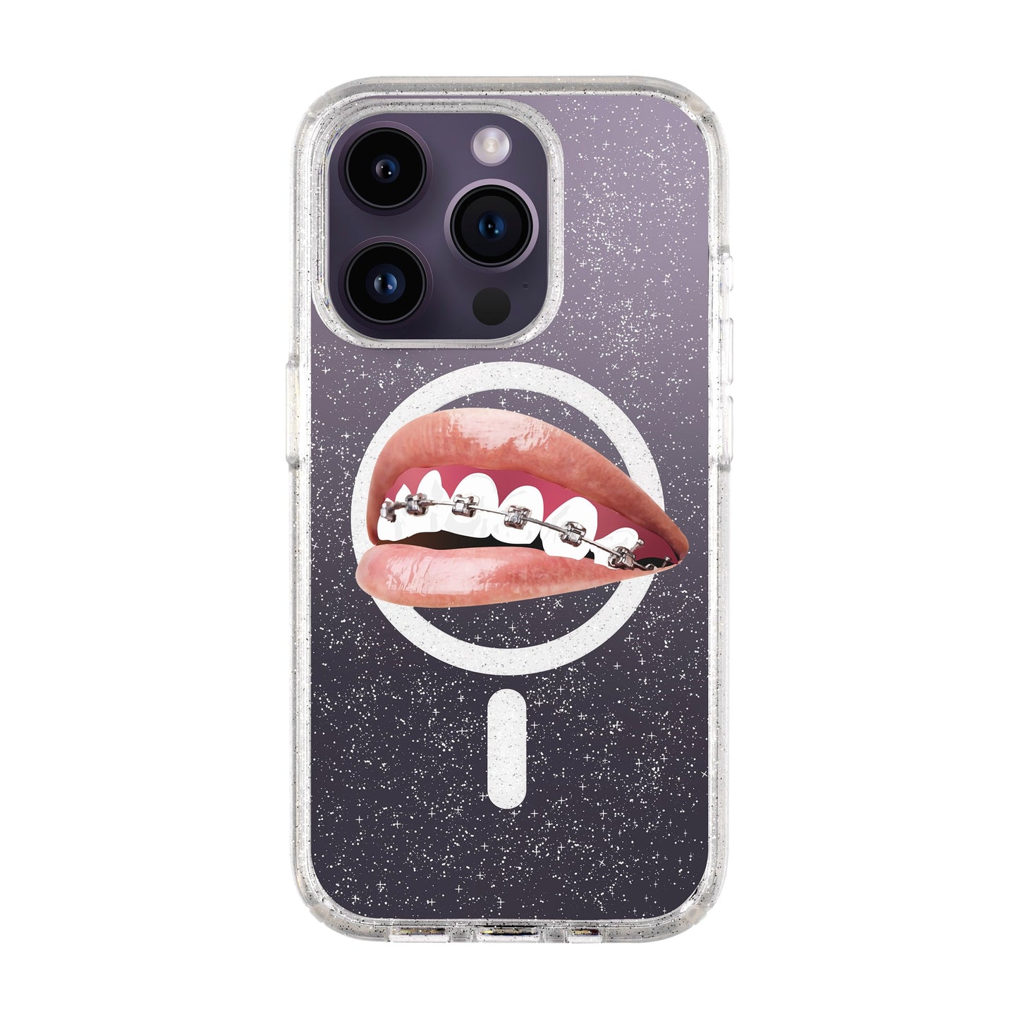 ORTHODONTIST-iPhone 14 Pro Shiny Kılıf MagSafe Özellikli