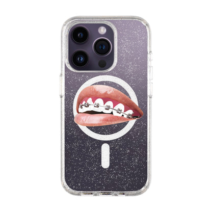 ORTHODONTIST-iPhone 14 Pro Shiny Kılıf MagSafe Özellikli