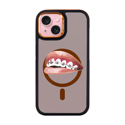 ORTHODONTIST-Dark Kılıf MagSafe Özellikli - iPhone 15