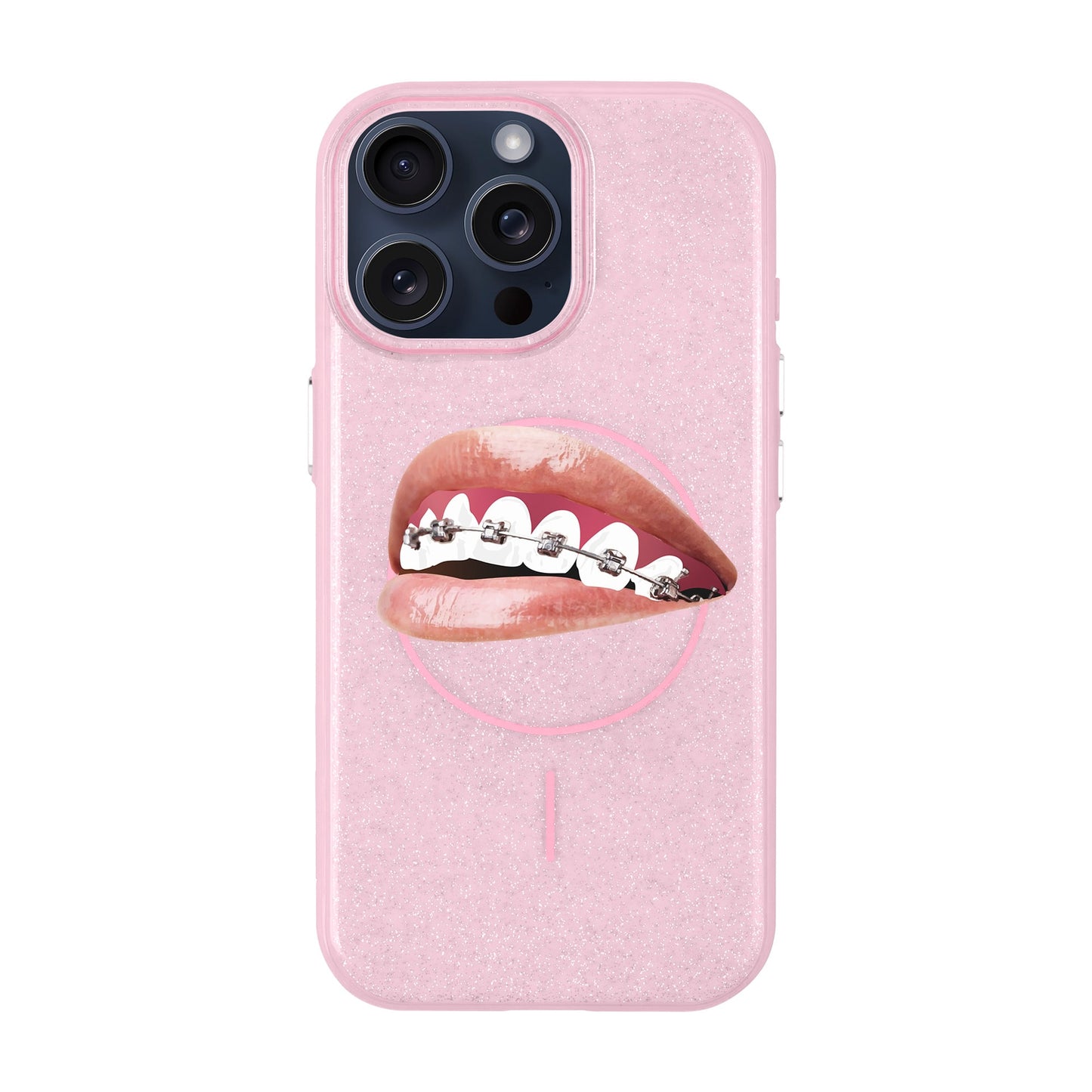 ORTHODONTIST-iPhone 15 Pro Max Radiant Kılıf MagSafe Özellikli
