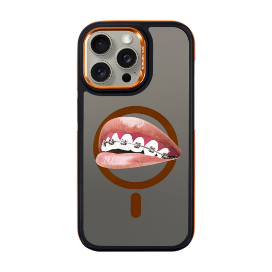 ORTHODONTIST-iPhone 15 Pro Max Dark Kılıf MagSafe Özellikli