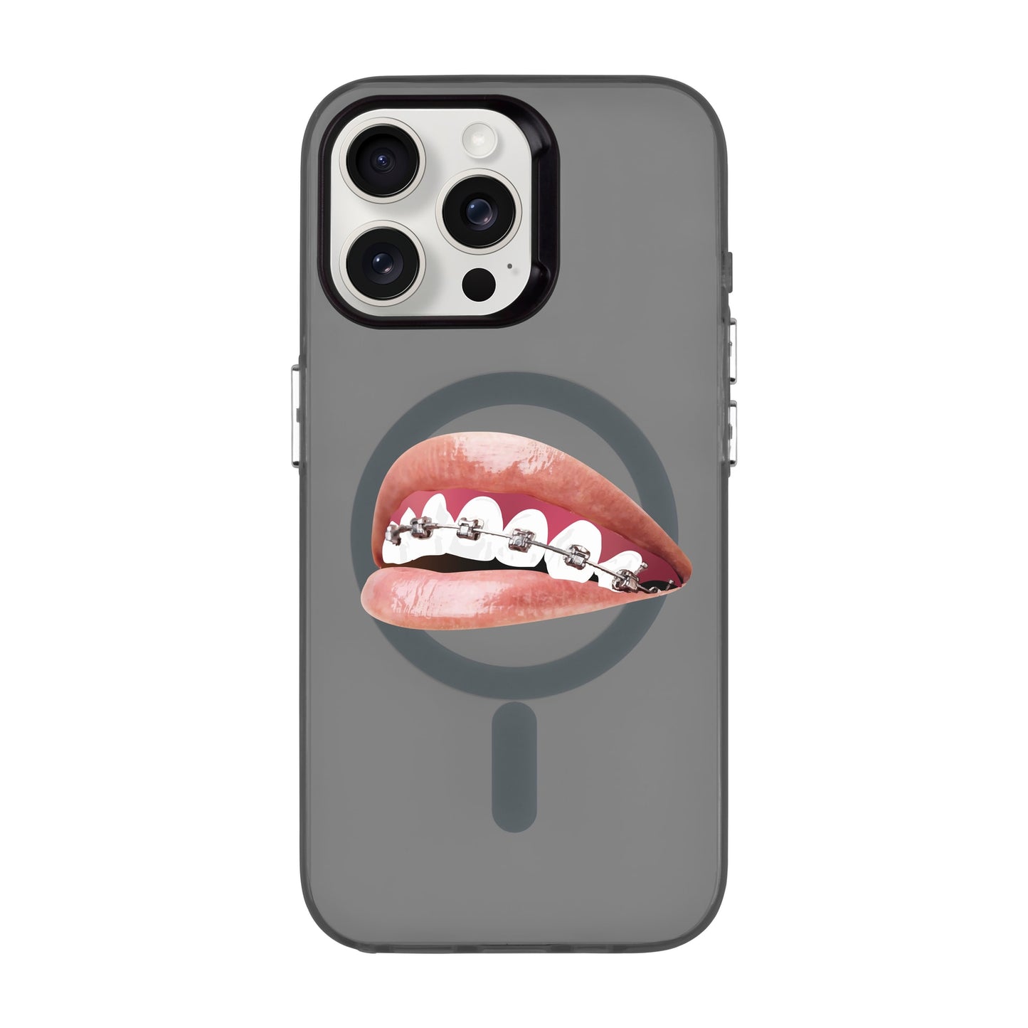 ORTHODONTIST-iPhone 15 Pro Max Hold Kılıf MagSafe Özellikli