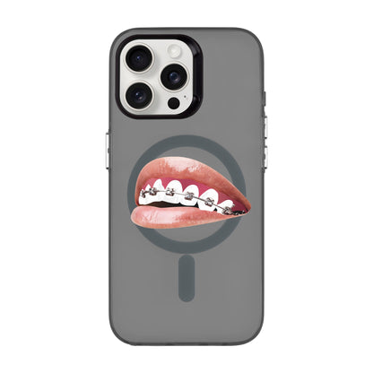 ORTHODONTIST-iPhone 15 Pro Max Hold Kılıf MagSafe Özellikli