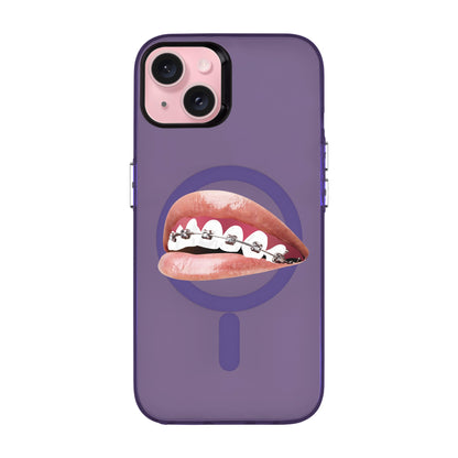 ORTHODONTIST-iPhone 15 Plus Hold Kılıf MagSafe Özellikli
