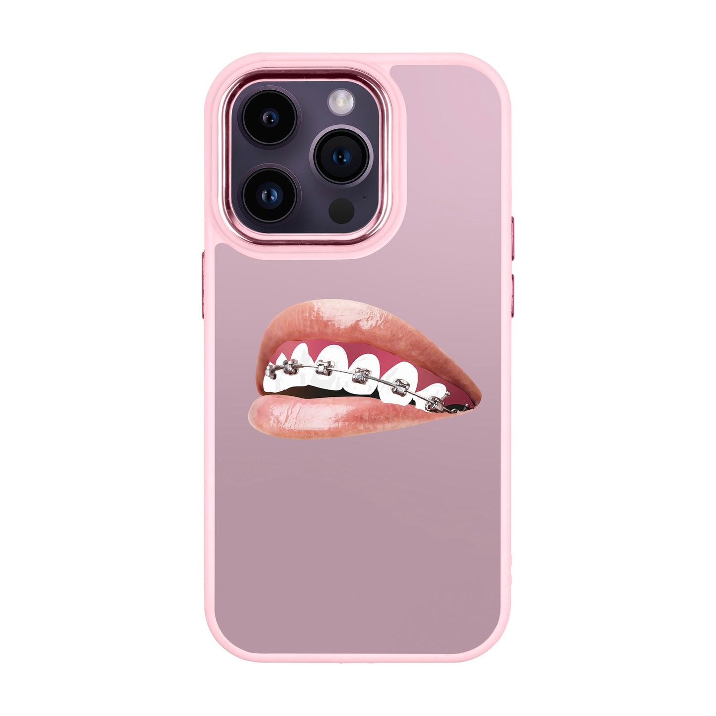 ORTHODONTIST-iPhone 14 Pro Proof Kılıf