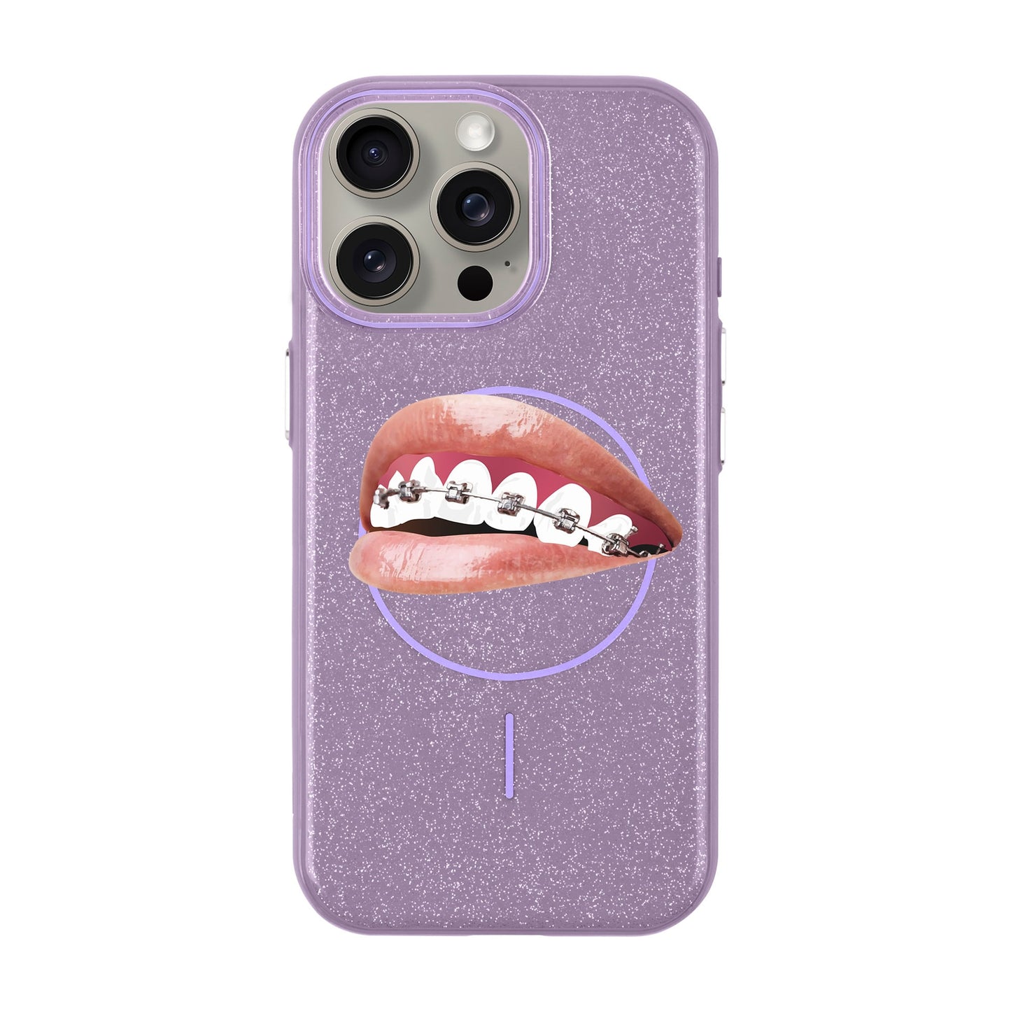 ORTHODONTIST-iPhone 15 Pro Max Radiant Kılıf MagSafe Özellikli