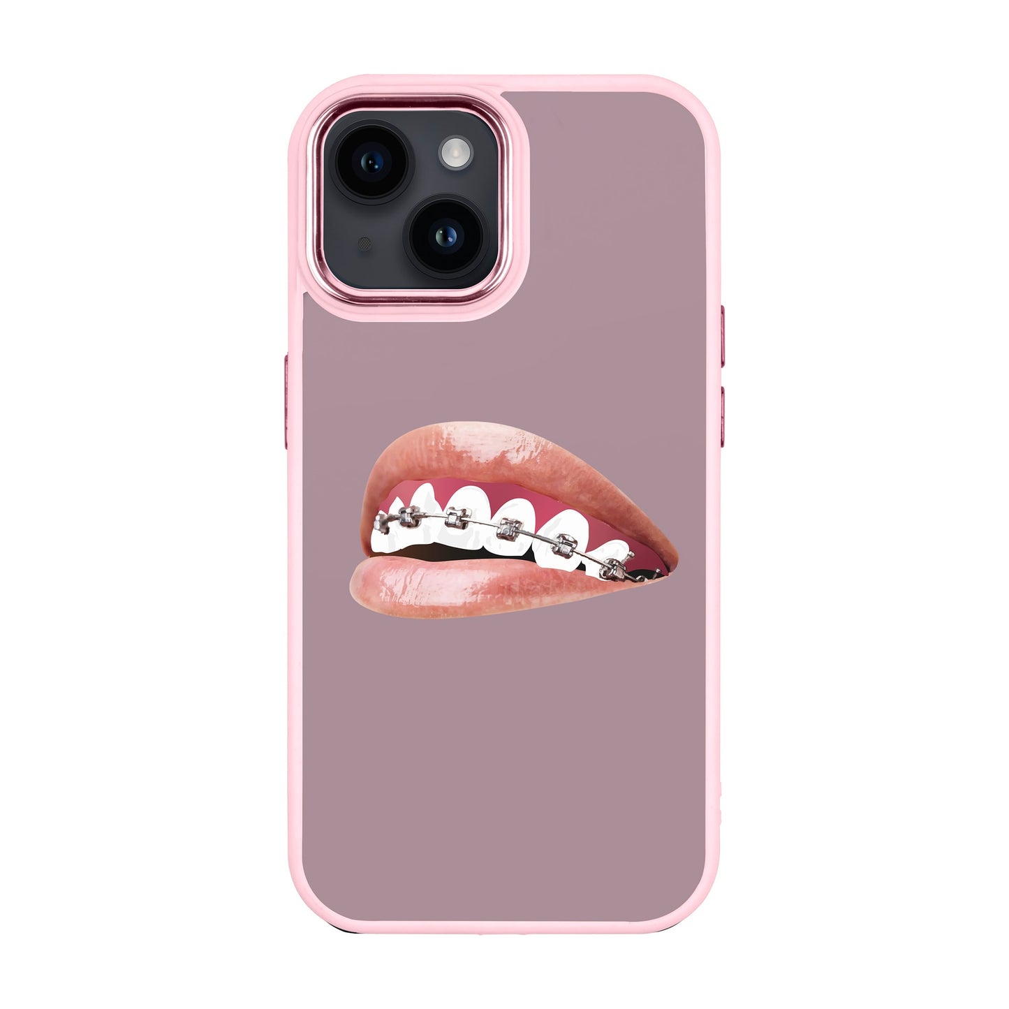 ORTHODONTIST-Proof Kılıf - iPhone 14
