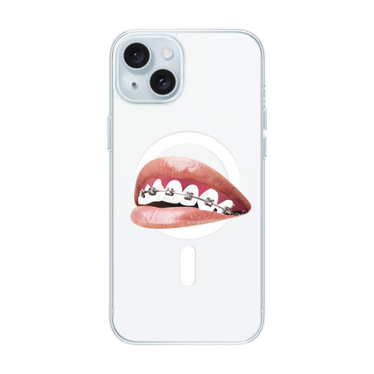 ORTHODONTIST-iPhone 15 Plus Solid Kılıf MagSafe Özellikli