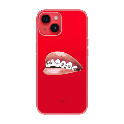 ORTHODONTIST-iPhone 14 Solid Kılıf